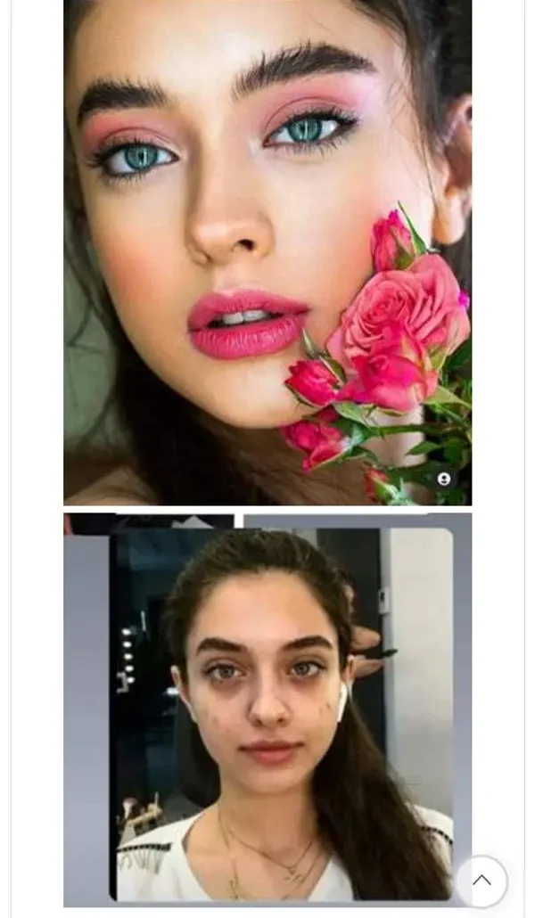 کیمیا حسینی قبل از عمل