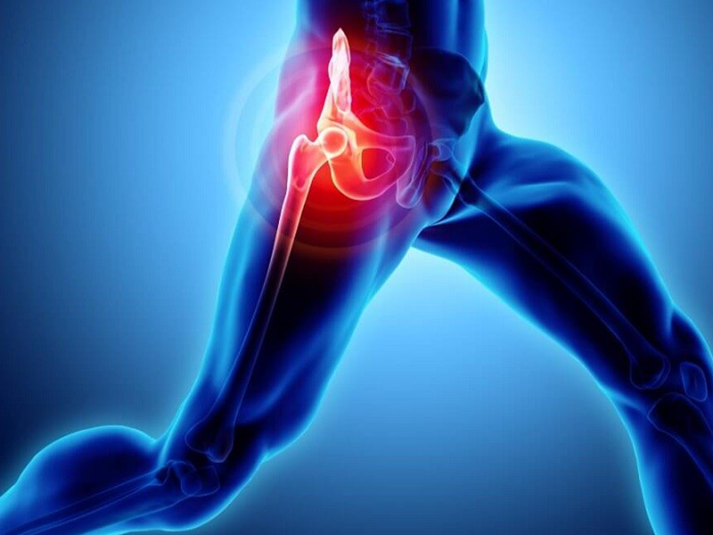 بیماری پوبالژیای شکمی یا فتق ورزشی بیماری پوبالژیای شکمی یا فتق ورزشی